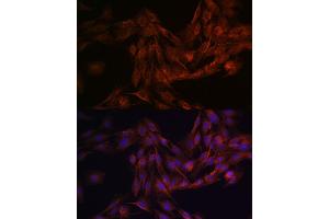 Immunofluorescence analysis of C6 cells using NMD Rabbit pAb (ABIN6133733, ABIN6141400, ABIN6141403 and ABIN6223602) at dilution of 1:100 (40x lens).