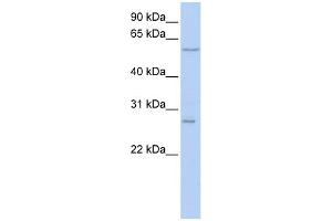 WB Suggested Anti-NETO2 Antibody Titration:  0. (NETO2 anticorps  (N-Term))