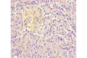 Immunohistochemistry of paraffin-embedded human pancreatic tissue using ABIN7149800 at dilution of 1:100 (DET1 anticorps  (AA 5-190))
