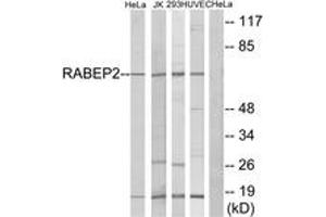 Western blot analysis of extracts from HeLa/Jurkat/293/HuvEc cells, using RABEP2 Antibody. (RABEP2 anticorps  (AA 353-402))