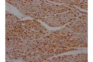 IHC image of ABIN7127803 diluted at 1:100 and staining in paraffin-embedded human heart tissue performed on a Leica BondTM system.