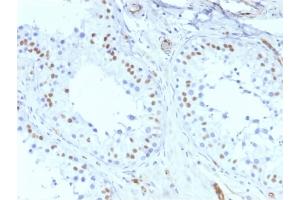 Formalin-fixed, paraffin-embedded human Testis stained with Wilm's Tumor Mouse Recombinant Monoclonal Antibody (rWT1/857).