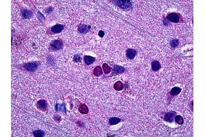 Anti-EBF3 antibody IHC of human brain, cortex.
