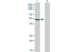 Western Blot analysis of VRK1 expression in transfected 293T cell line by VRK1 monoclonal antibody (M02), clone 4F9.