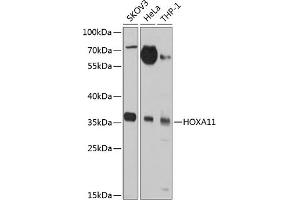Western blot analysis of extracts of various cell lines, using HOX antibody (ABIN3017106, ABIN3017107, ABIN1680330 and ABIN6219956) at 1:1000 dilution. (Homeobox A11 anticorps  (AA 1-180))