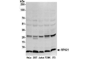 anti-Ribosomal Protein S21 (RPS21) (AA 33-83) antibody