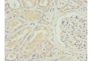 Immunohistochemistry of paraffin-embedded human kidney tissue using ABIN7170087 at dilution of 1:100