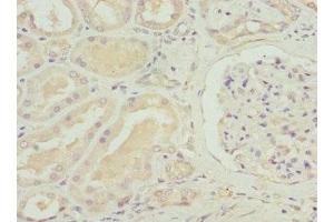 Immunohistochemistry of paraffin-embedded human kidney tissue using ABIN7170087 at dilution of 1:100 (SLC12A6 anticorps  (AA 60-190))