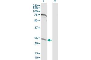 Western Blot analysis of MIS12 expression in transfected 293T cell line by MIS12 MaxPab polyclonal antibody. (MIS12 anticorps  (AA 1-205))