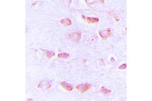 Immunohistochemical analysis of Histamine H3 Receptor staining in human brain formalin fixed paraffin embedded tissue section. (HRH3 anticorps  (Center))