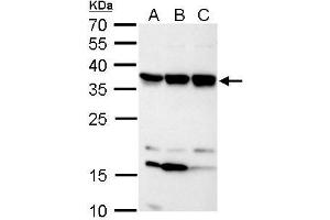 WB Image C11orf54 antibody detects C11orf54 protein by Western blot analysis. (C11orf54 anticorps)
