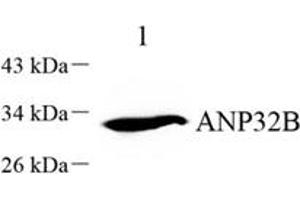 Western blot analysis of APRIL (ABIN7072887) at dilution of 1: 1000,Lane 1: Jurkat cell lysate (ANP32B anticorps)