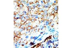 Image no. 1 for anti-NME/NM23 Nucleoside Diphosphate Kinase 4 (NME4) (C-Term) antibody (ABIN360669) (NME4 anticorps  (C-Term))