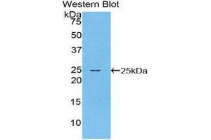 Western Blotting (WB) image for anti-Filaggrin (FLG) (AA 3905-4031) antibody (ABIN1078038) (Filaggrin anticorps  (AA 3905-4031))