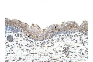 Ribophorin II antibody was used for immunohistochemistry at a concentration of 4-8 ug/ml to stain Squamous epithelial cells (arrows) in Human Skin. (Ribophorin II anticorps  (N-Term))