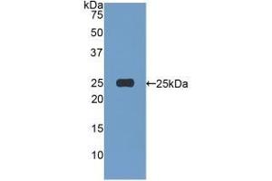 WB of Protein Standard: different control antibodies  against Highly purified E. (Afamin Kit ELISA)