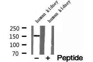 Western blot analysis of extracts of human kidney tissue, using RPGRIP1L antibody. (RPGRIP1L anticorps  (N-Term))