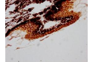 IHC image of ABIN7127798 diluted at 1:100 and staining in paraffin-embedded human eye tissue performed on a Leica BondTM system. (Recombinant RPE65 anticorps)