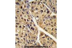 Immunohistochemistry (IHC) image for anti-Peroxisomal Biogenesis Factor 11 alpha (PEX11A) antibody (ABIN3004001)