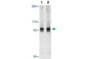 Western blot analysis of NARP2 in PC-3 cell lysate with NLRP2 polyclonal antibody  at 1 and 2 ug/mL . (NLRP2 anticorps  (C-Term))