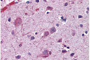 Human Brain, Cortex: Formalin-Fixed, Paraffin-Embedded (FFPE)