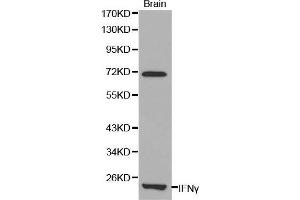 Western Blotting (WB) image for anti-Interferon gamma (IFNG) (AA 24-166) antibody (ABIN1513061) (Interferon gamma anticorps  (AA 24-166))