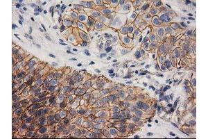 Image no. 2 for anti-Catenin (Cadherin-Associated Protein), beta 1, 88kDa (CTNNB1) antibody (ABIN1496889)