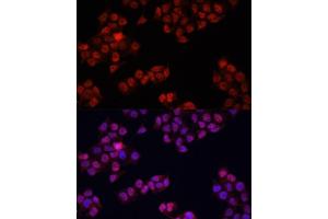 Immunofluorescence analysis of HeLa cells using Y antibody (ABIN6132789, ABIN6150317, ABIN6150322 and ABIN6215136) at dilution of 1:100. (YAP1 anticorps  (AA 155-504))