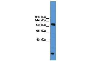 Western Blot showing USP15 antibody used at a concentration of 1-2 ug/ml to detect its target protein. (USP15 anticorps  (C-Term))
