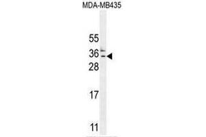 CK073 Antibody (N-term) western blot analysis in MDA-MB435 cell line lysates (35µg/lane).