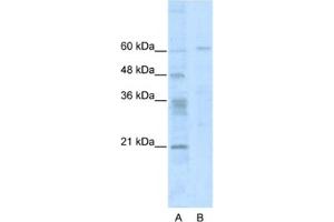 Western Blotting (WB) image for anti-Zinc Finger Protein 192 (ZNF192) antibody (ABIN2461595) (ZNF192 anticorps)