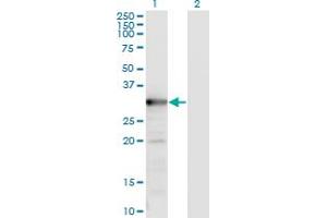 Western Blot analysis of TYMS expression in transfected 293T cell line by TYMS monoclonal antibody (M02), clone 2B2. (TYMS anticorps  (AA 111-210))