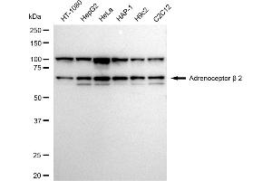 Western blotting analysis using Adrenoceptor beta 2 antibody (ABIN7797536).