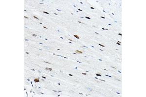 Immunohistochemistry of paraffin-embedded mouse heart using TE Rabbit pAb (ABIN6129488, ABIN6148982, ABIN6148984 and ABIN6217332) at dilution of 1:100 (40x lens).