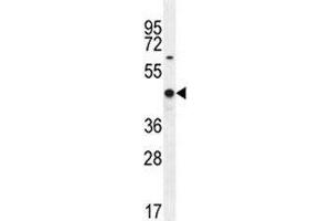 WT1 antibody western blot analysis in MCF-7 lysate.
