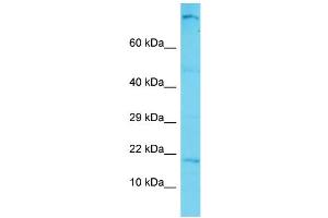 Host: Rabbit Target Name: C12orf74 Sample Type: Hela Whole cell lysates Antibody Dilution: 1. (C12ORF74 anticorps  (N-Term))