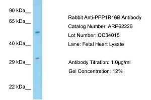 Western Blotting (WB) image for anti-Protein Phosphatase 1, Regulatory Subunit 16B (PPP1R16B) (N-Term) antibody (ABIN2774338) (PPP1R16B anticorps  (N-Term))