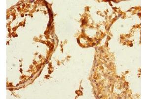Immunohistochemistry of paraffin-embedded human testis tissue using ABIN7161113 at dilution of 1:100