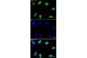 Histone H3 trimethyl Lys9 antibody tested by immunofluorescence.