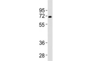 Western blot testing of SPHK2 antibody at 1:2000 dilution + human liver lysate