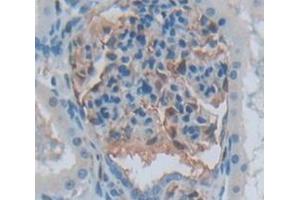 Used in DAB staining on fromalin fixed paraffin- embedded Kidney tissue (Aurora Kinase C anticorps  (AA 92-339))