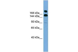 WB Suggested Anti-UGCGL1  Antibody Titration: 0.