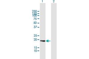 Western Blot analysis of CETN3 expression in transfected 293T cell line by CETN3 MaxPab polyclonal antibody. (CETN3 anticorps  (AA 1-167))