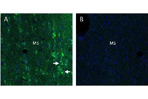 Stromal interaction molecule 2 (STIM2) in rat medial septum (MS) regionA. (Stim2 anticorps  (Intracellular))