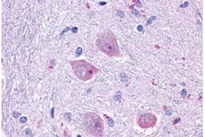 Immunohistochemical staining of human brain, neurons and glia with CHRM4 polyclonal antibody . (CHRM4 anticorps  (Cytoplasmic Domain))