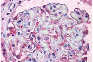 Human Kidney: Formalin-Fixed, Paraffin-Embedded (FFPE)