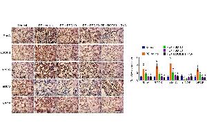 IHC analyzes the expression of RhoA, ROCK, p-MLC, eNOS and VEGF in placenta from PE miceRepresentative images of IHC staining for RhoA, ROCK, p-MLC, eNOS and VEGF (left), and quantification (right).