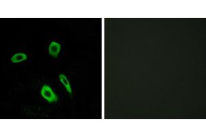 Peptide - +Western blot analysis of extracts from Jurkat cells, using EDG7 antibody. (LPAR3 anticorps  (Internal Region))