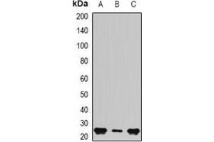 Western blot analysis of BAG2 expression in Hela (A), Jurkat (B), HepG2 (C) whole cell lysates.