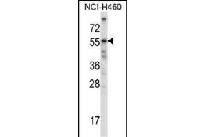 Mouse Acvr2b Antibody (Center) (ABIN657829 and ABIN2846796) western blot analysis in NCI- cell line lysates (35 μg/lane). (ACVR2B anticorps  (AA 148-176))